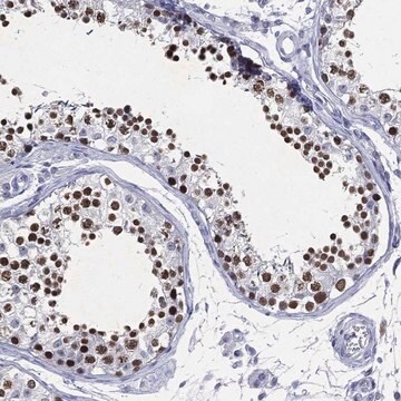 Anti-Ssx1 Antibody Produced In Rabbit Prestige Antibodies&#174; Powered by Atlas Antibodies, affinity isolated antibody, buffered aqueous glycerol solution