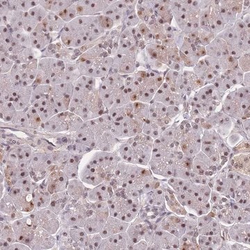 Anti-SNRPA1 antibody produced in rabbit Prestige Antibodies&#174; Powered by Atlas Antibodies, affinity isolated antibody, buffered aqueous glycerol solution