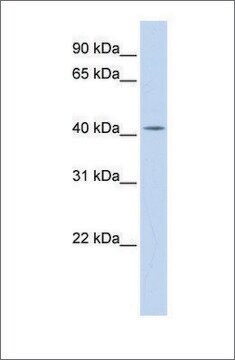 Anti-DHDDS antibody produced in rabbit affinity isolated antibody