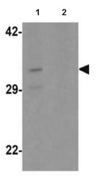 Anti-CLEC2A Antibody from rabbit, purified by affinity chromatography