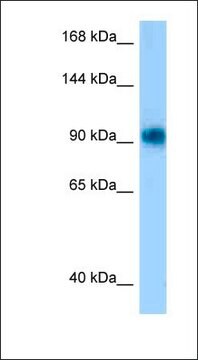 Anti-PRKD1 antibody produced in rabbit affinity isolated antibody