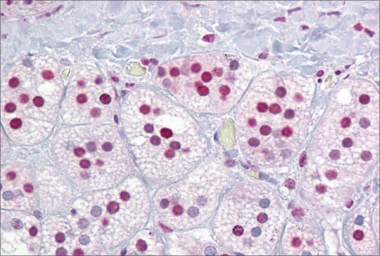 Anti-RORA (ab3) antibody produced in rabbit affinity isolated antibody