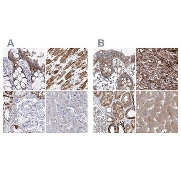 Anti-COQ3 antibody produced in rabbit Prestige Antibodies&#174; Powered by Atlas Antibodies, affinity isolated antibody, buffered aqueous glycerol solution, ab2