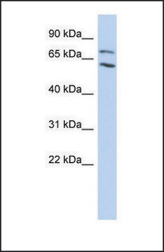 Anti-MTA2, (N-terminal) antibody produced in rabbit affinity isolated antibody