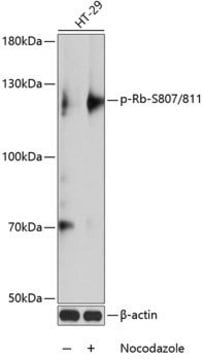 Anti-Phospho-Rb-S807/811 antibody produced in rabbit