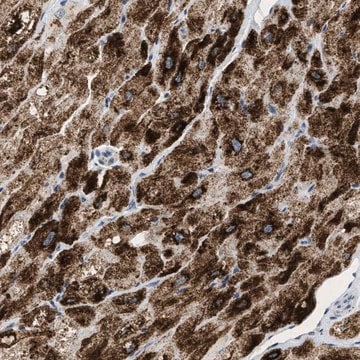 Anti-PPM1L antibody produced in rabbit Prestige Antibodies&#174; Powered by Atlas Antibodies, affinity isolated antibody, buffered aqueous glycerol solution, Ab2