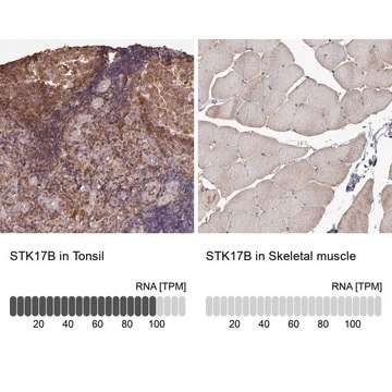 Anti-STK17B antibody produced in rabbit Prestige Antibodies&#174; Powered by Atlas Antibodies, affinity isolated antibody, buffered aqueous glycerol solution