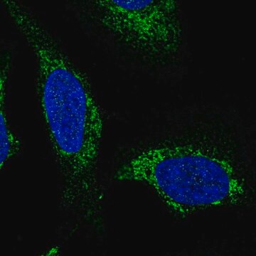 Anti-SLC25A44 antibody produced in rabbit Prestige Antibodies&#174; Powered by Atlas Antibodies, affinity isolated antibody