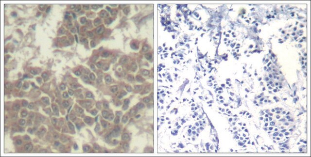 Anti-JAK2 (Ab-570) antibody produced in rabbit affinity isolated antibody