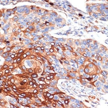 Anti-ORM1 antibody produced in rabbit