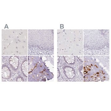 Anti-ACAN antibody produced in rabbit Prestige Antibodies&#174; Powered by Atlas Antibodies, affinity isolated antibody