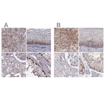 Anti-HSP90AB1 antibody produced in rabbit Prestige Antibodies&#174; Powered by Atlas Antibodies, affinity isolated antibody