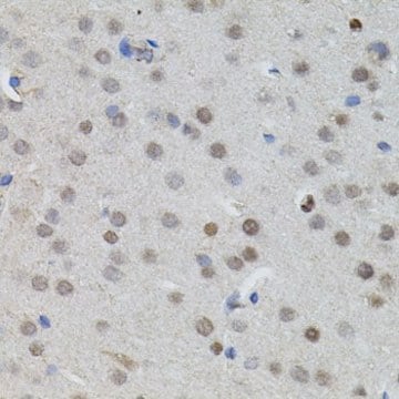 Anti-MYCN antibody produced in rabbit