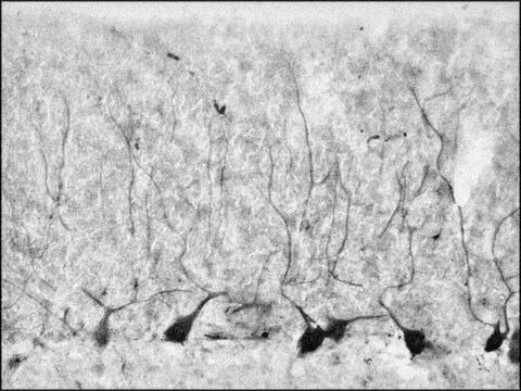 Anti-HAP1 (C-terminal) antibody produced in rabbit ~1.5&#160;mg/mL, affinity isolated antibody