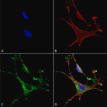 Monoclonal Anti-Copper Transporting Atpase 1 - Biotin antibody produced in mouse clone S60-4, purified immunoglobulin