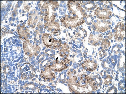 Anti-AADAT antibody produced in rabbit IgG fraction of antiserum