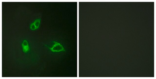 Anti-IL-8R &#946; antibody produced in rabbit affinity isolated antibody