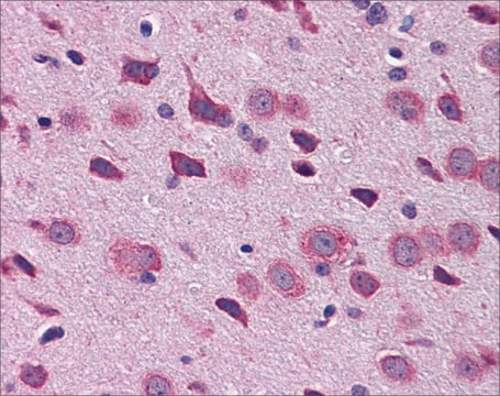 Anti-TBR1, (N-terminal) antibody produced in rabbit affinity isolated antibody