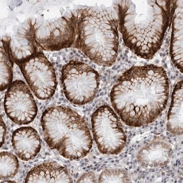 Anti-WDTC1 antibody produced in rabbit Prestige Antibodies&#174; Powered by Atlas Antibodies, affinity isolated antibody, buffered aqueous glycerol solution, ab2