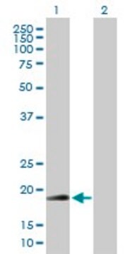 Anti-RNF185 antibody produced in mouse purified immunoglobulin, buffered aqueous solution