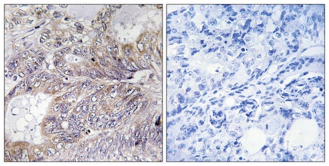 Anti-BAD antibody produced in rabbit affinity isolated antibody