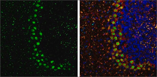 Anti-PPP1CB antibody produced in rabbit