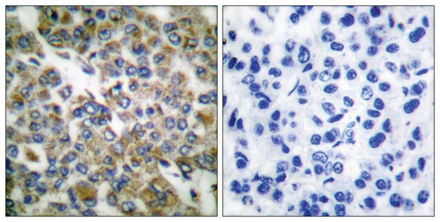 Anti-Keratin 14 antibody produced in rabbit affinity isolated antibody