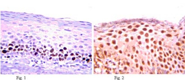 Anti-MEF2D Antibody from rabbit, purified by affinity chromatography