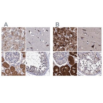 Anti-CLPB antibody produced in rabbit Prestige Antibodies&#174; Powered by Atlas Antibodies, affinity isolated antibody, buffered aqueous glycerol solution