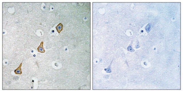 抗 PECAM-1 兔抗 affinity isolated antibody