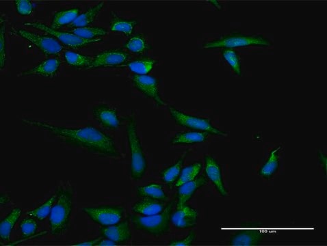 Anti-INPP5B antibody produced in rabbit purified immunoglobulin, buffered aqueous solution