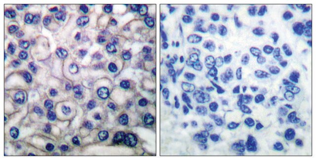 Anti-EGFR antibody produced in rabbit affinity isolated antibody