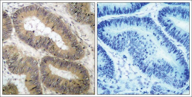 Anti-phospho-CHUK (pThr23) antibody produced in rabbit affinity isolated antibody