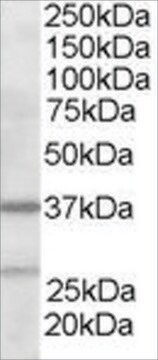 Anti-ARP2/3 subunit 1B antibody produced in goat affinity isolated antibody, buffered aqueous solution