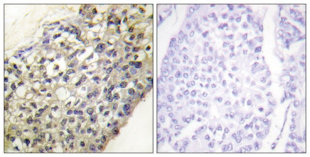 Anti-LATH antibody produced in rabbit affinity isolated antibody