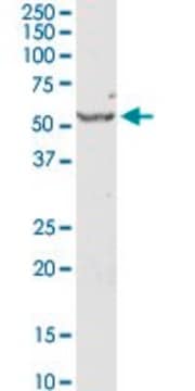 Anti-SERPINE1 antibody produced in rabbit purified immunoglobulin, buffered aqueous solution