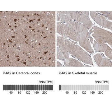 Anti-PJA2 antibody produced in rabbit Prestige Antibodies&#174; Powered by Atlas Antibodies, affinity isolated antibody, buffered aqueous glycerol solution