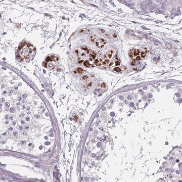 Anti-SLC35E4 antibody produced in rabbit Prestige Antibodies&#174; Powered by Atlas Antibodies, affinity isolated antibody, buffered aqueous glycerol solution