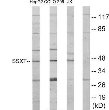 Anti-SSXT, N-Terminal antibody produced in rabbit affinity isolated antibody