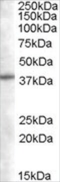 Anti-SNX16 antibody produced in goat affinity isolated antibody, buffered aqueous solution