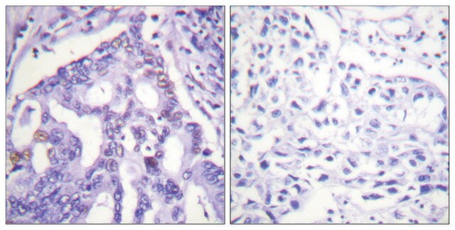 Anti-PIAS4 antibody produced in rabbit affinity isolated antibody