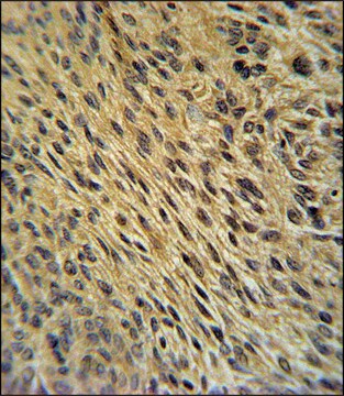 ANTI-CCDC62 (C-TERM) antibody produced in rabbit IgG fraction of antiserum, buffered aqueous solution