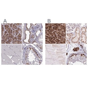 Anti-TPP1 antibody produced in rabbit Prestige Antibodies&#174; Powered by Atlas Antibodies, affinity isolated antibody, buffered aqueous glycerol solution