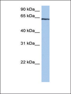 Anti-TTC6 antibody produced in rabbit affinity isolated antibody