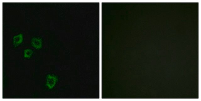 Anty-MUC16 affinity isolated antibody