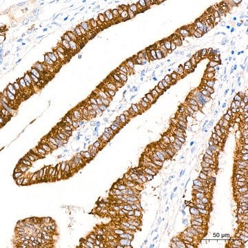 Anti-COX2/PTGS2 Antibody, clone 2V7G8, Rabbit Monoclonal