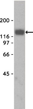 Anticuerpo anti-&#945;-distroglucano, clon VIA4-1 culture supernatant, clone VIA4-1, Upstate&#174;