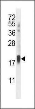 ANTI-ZNF593 (CENTER) antibody produced in rabbit IgG fraction of antiserum, buffered aqueous solution