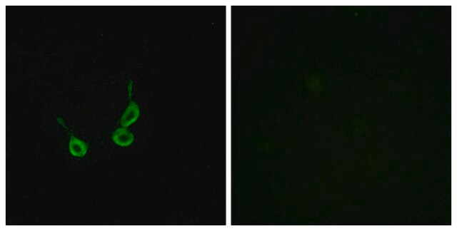 Anti-GPR150 antibody produced in rabbit affinity isolated antibody