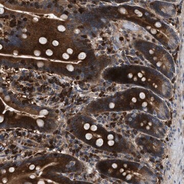 Anti-OSTF1 antibody produced in rabbit Prestige Antibodies&#174; Powered by Atlas Antibodies, affinity isolated antibody, buffered aqueous glycerol solution